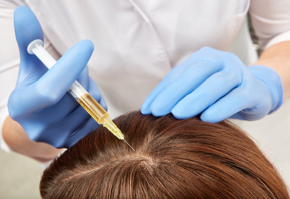 PRP Therapy in Karachi